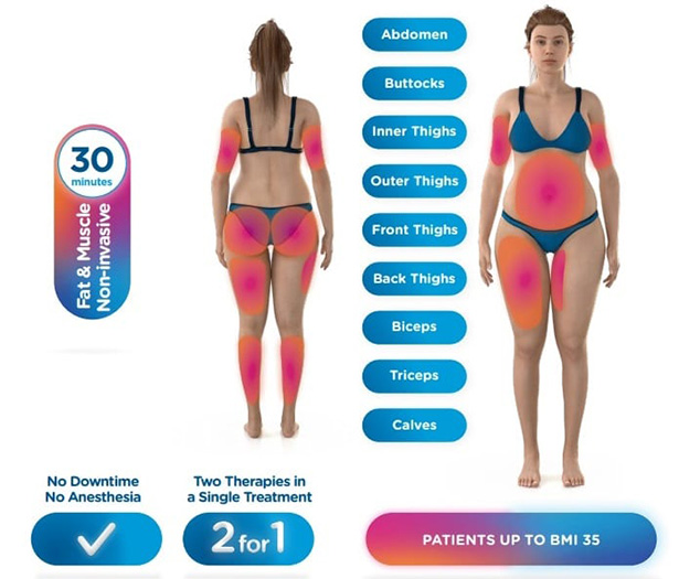 ULTRA FEMME 360 London Fulham Innovative vaginal rejuvenation treatment